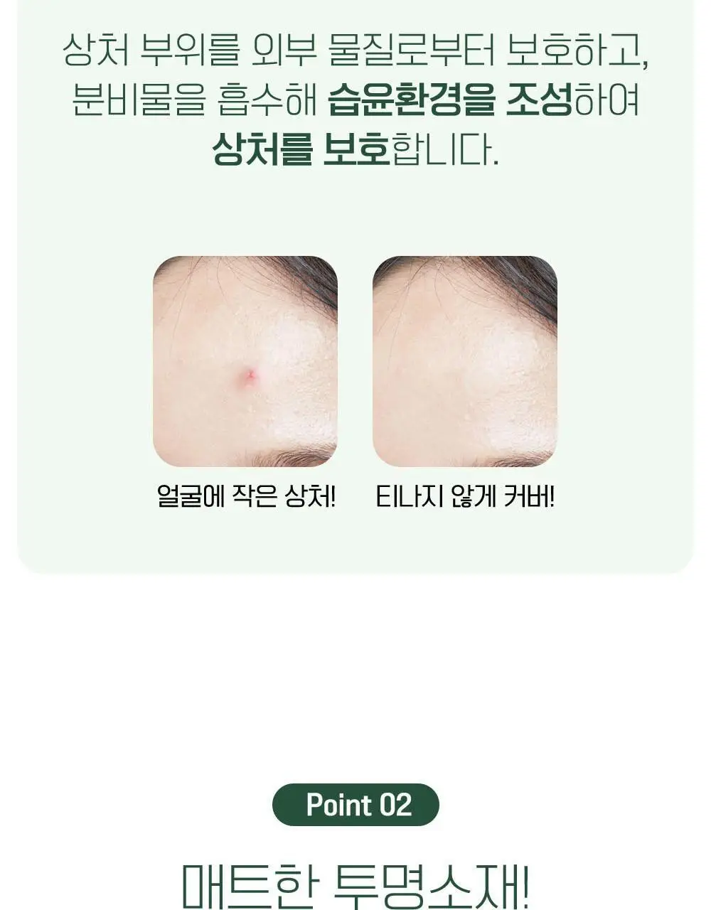 [단독기획] 마데카 메디패치 스팟패치 (33매/99매) 상세페이지 14